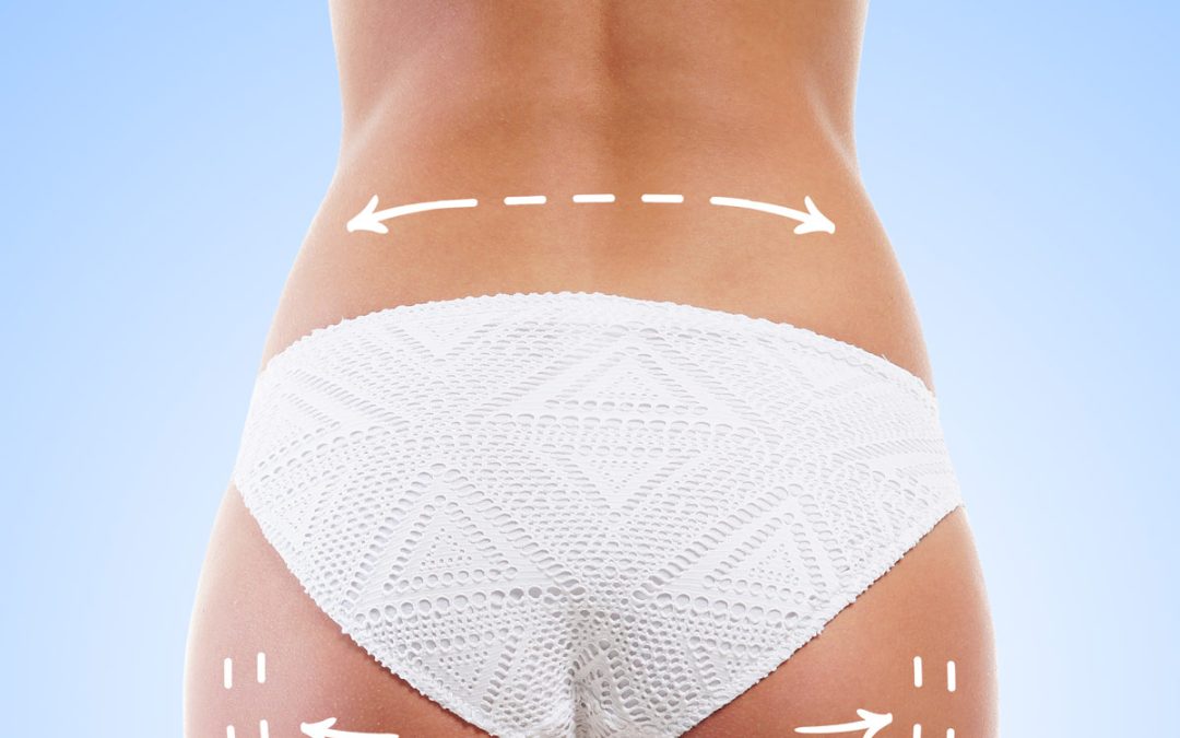 Sculpt, Tone & Tighten with the Future of Body Contouring